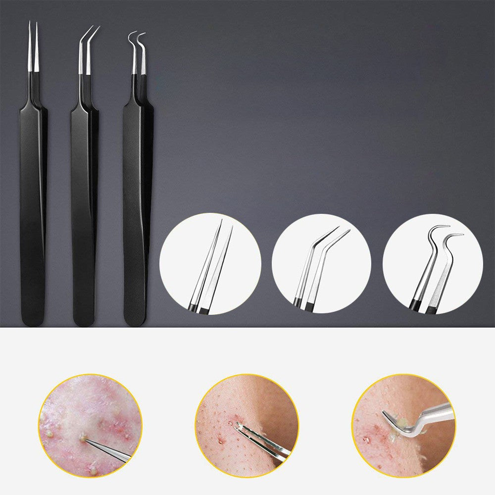 Set of 10Pcs Blackheads Remover Comedone Extractor Pimple Popper Tool Kit Black