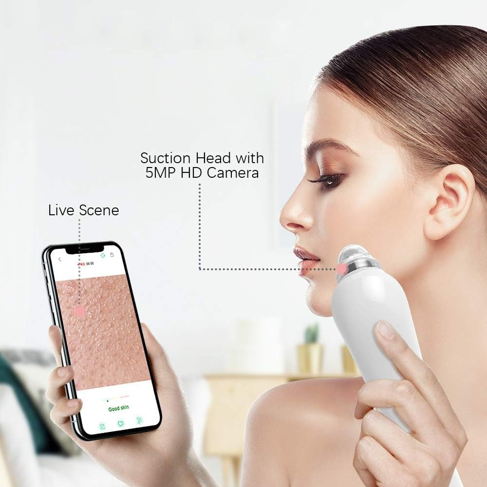 Blackhead Remover Pore Vacuum Visual Facial Pore Cleanser with 6 Suction Heads