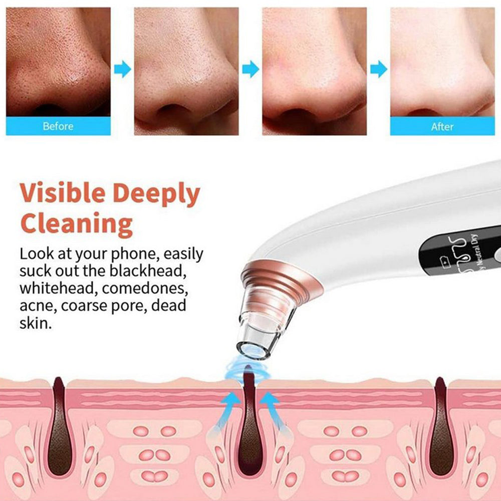 Visible Rechargeable 3 Suction Blackhead Remover Camera Vacuum Pore Acne Cleaner