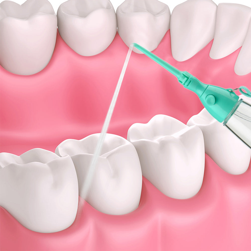 2Pcs Non Electric Water Flosser Oral Irrigator