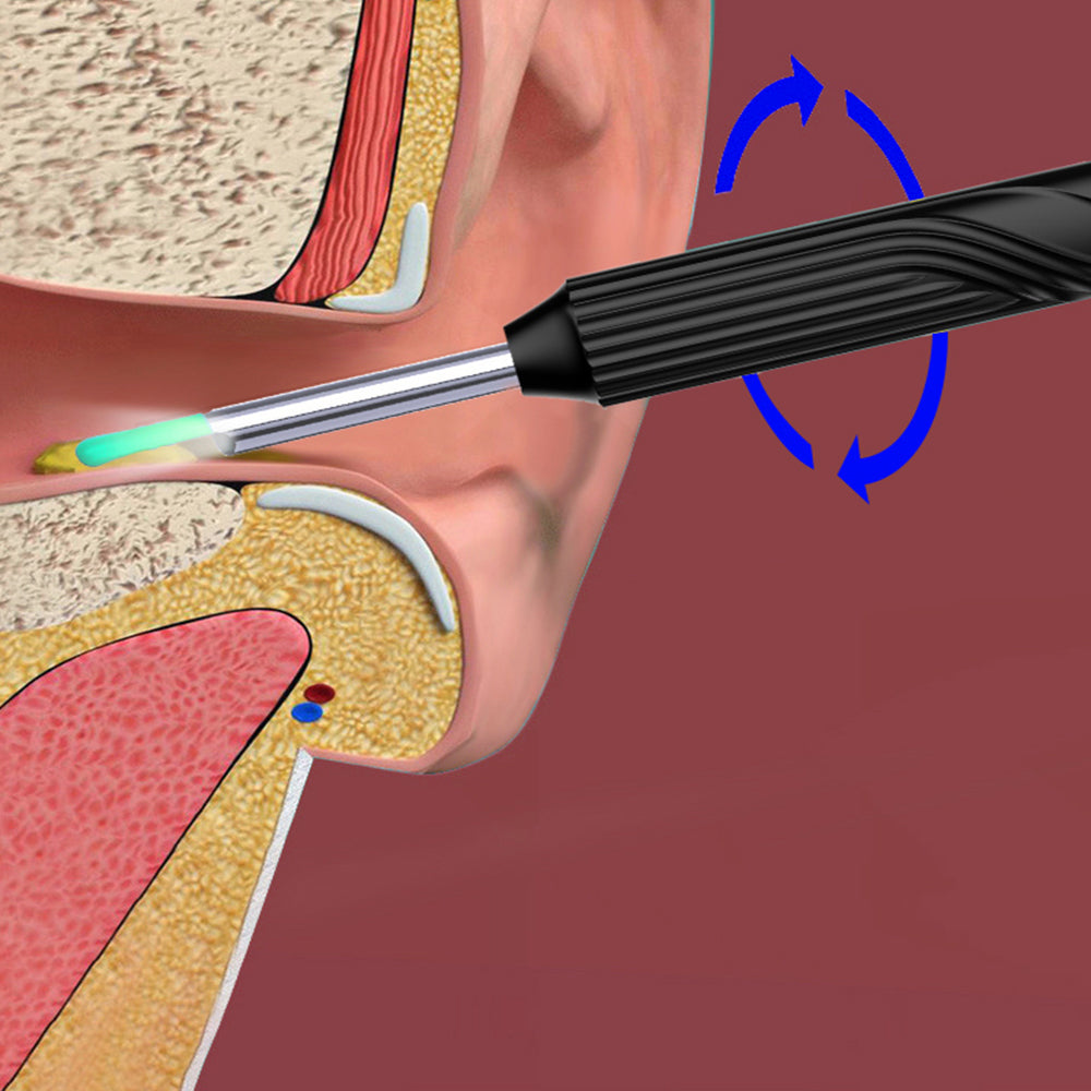 Wireless Otoscope Ear Wax Remover WiFi Earwax Removal Tool with Ear Camera-Black