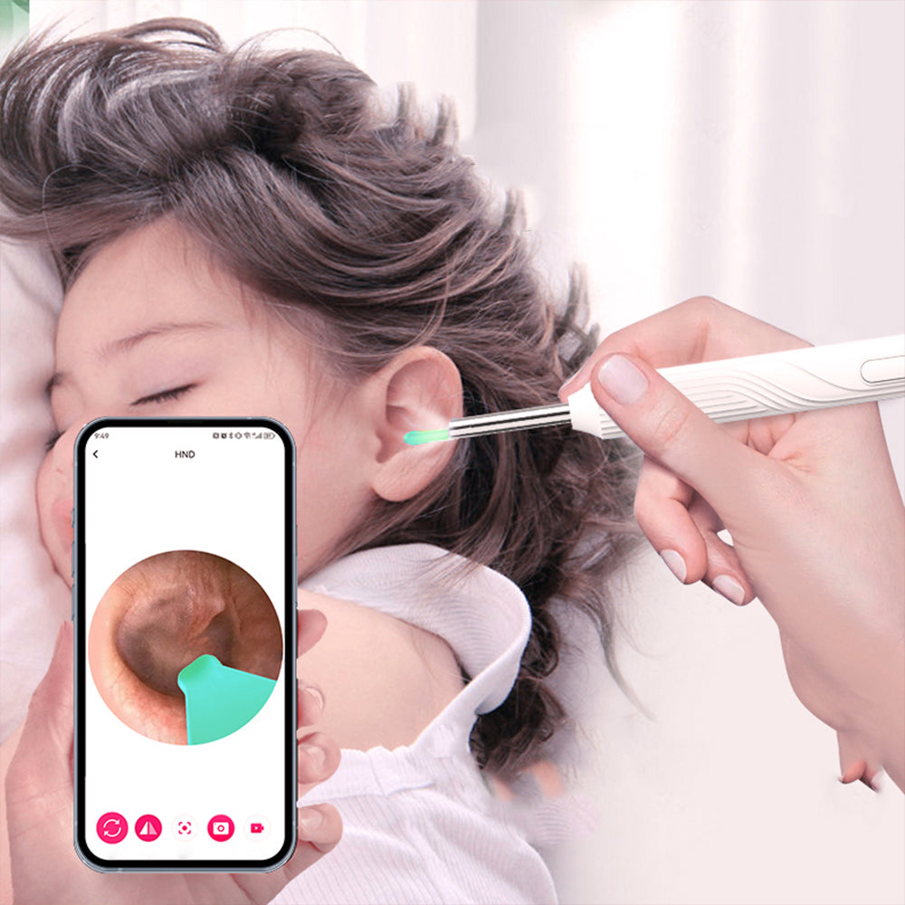Wireless Otoscope Ear Wax Remover WiFi Earwax Removal Tool with Ear Camera-White