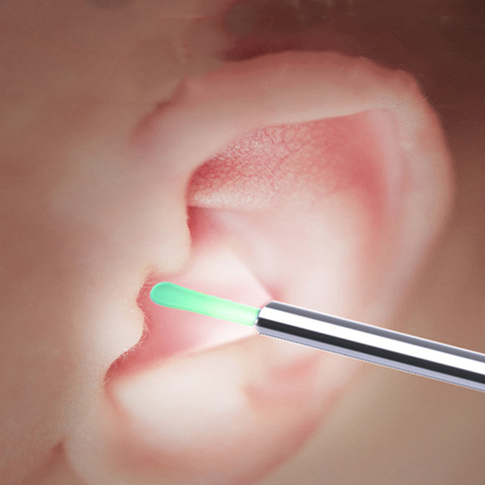 Wireless Otoscope Ear Wax Remover WiFi Earwax Removal Tool with Ear Camera-White