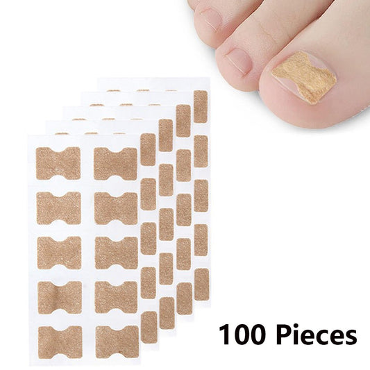100 Pieces Toenail Ingrown Correction Stickers