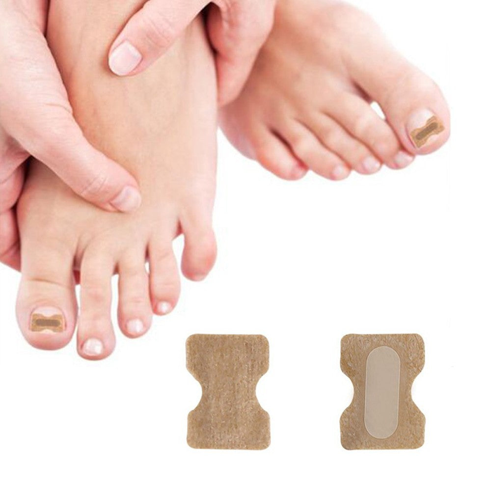 100 Pieces Toenail Ingrown Correction Stickers