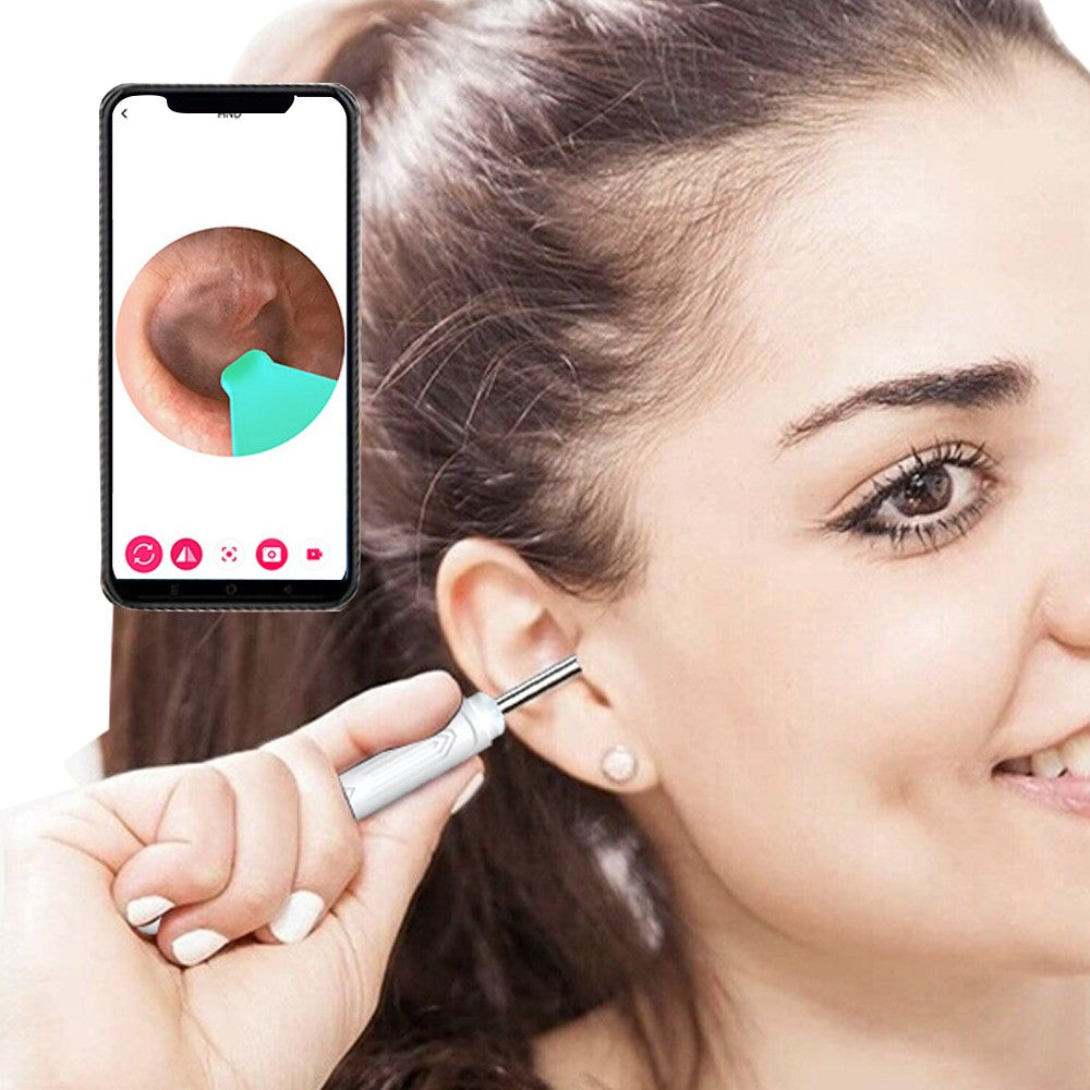 Wireless Visual Otoscope WiFi Ear Wax Removal Tool with Ear Pick Set - White
