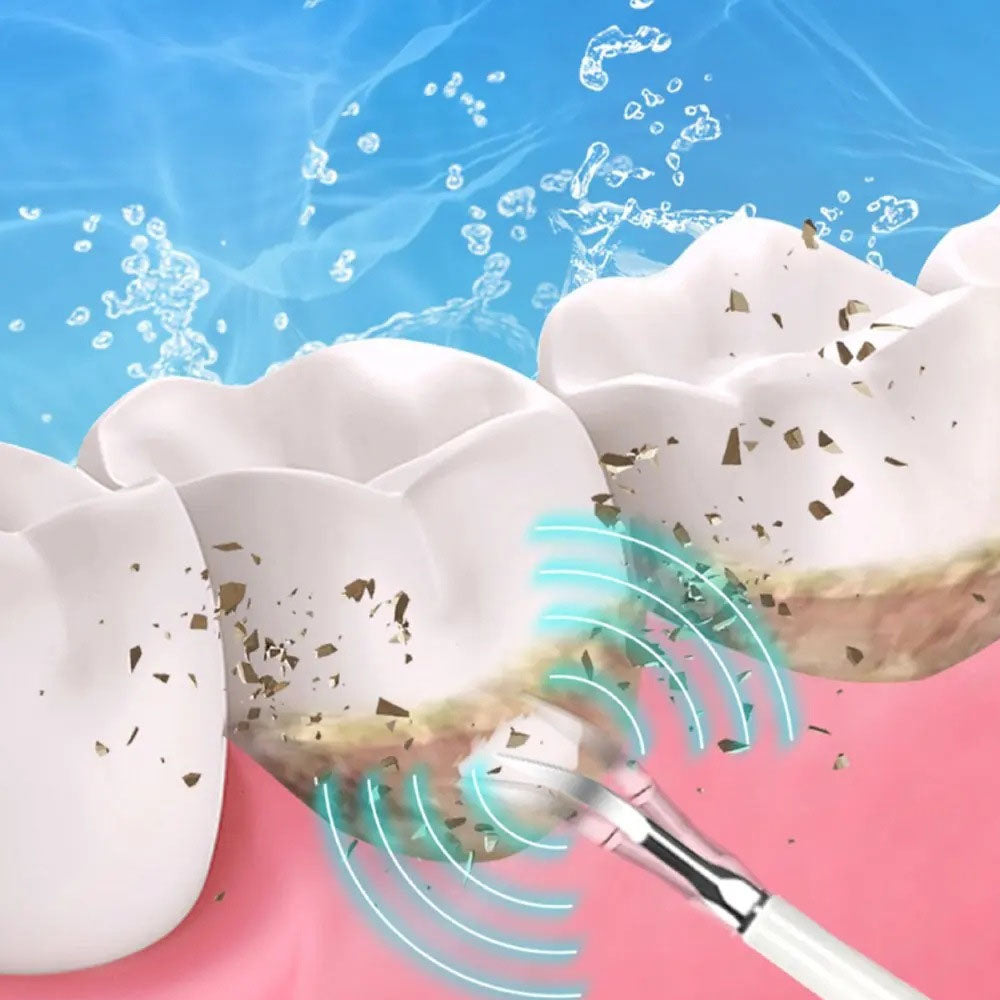 6 in 1 Electric Ultrasonic Dental Calculus Remover Teeth Cleaner White