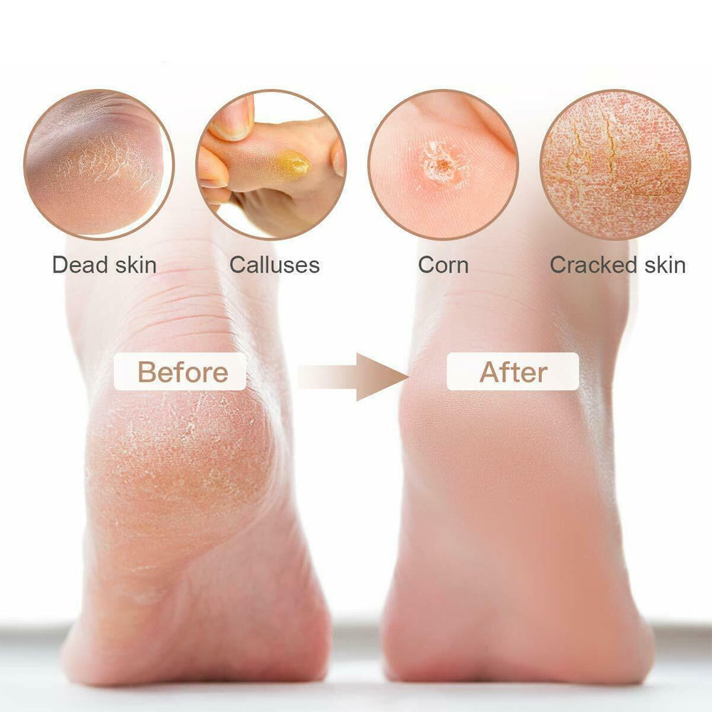 10Pcs Rechargeable Foot Callus Remover Water-Resistant Foot File Pedicure -Black