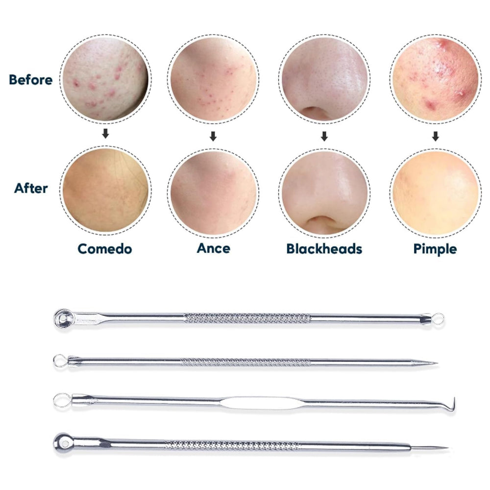 Vacuum Blackhead Remover Acne Pimple with 5 Suction Probes 4 Acne Needles Silver