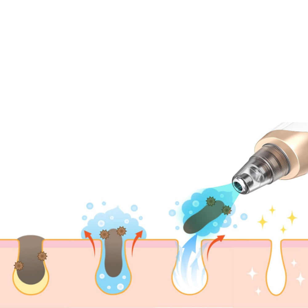 Vacuum Blackhead Remover Acne Pimple with 5 Suction Probes 4 Acne Needles Silver