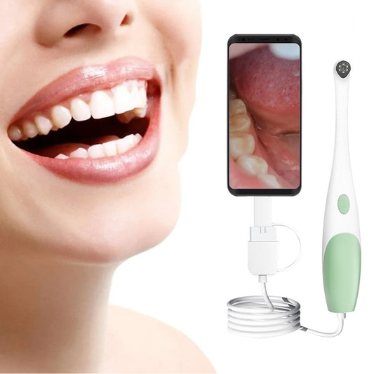 1080P Dental Intraoral Camera Digital Oral Endoscope with LED Lights