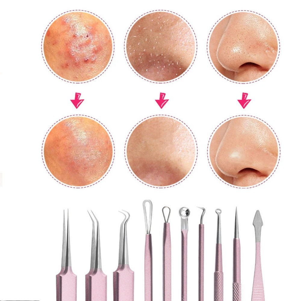 Set of 10Pcs Blackheads Remover Comedone Extractor Pimple Popper Tool Kit Pink
