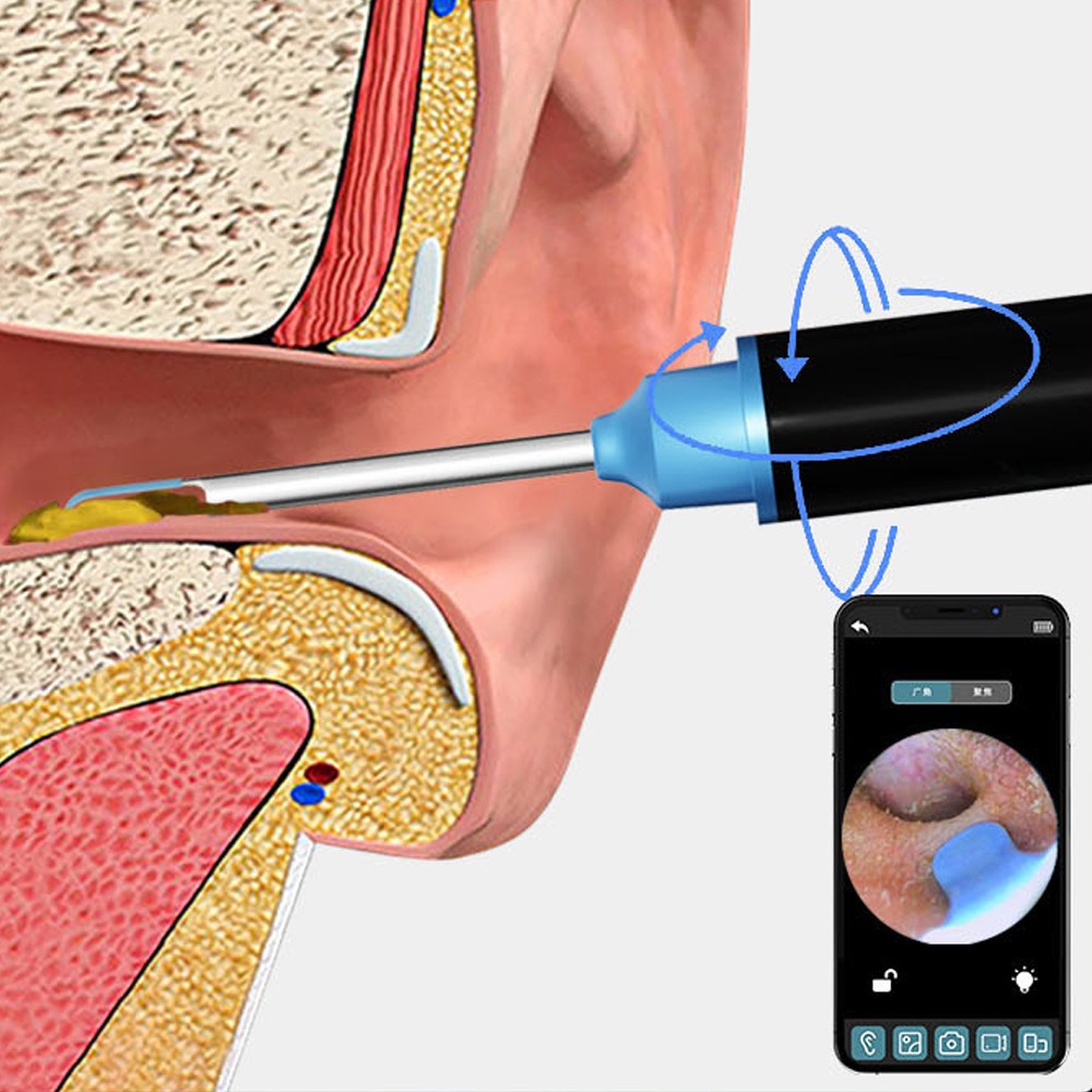 Ear Wax Removal Tool Ear Cleaner with Camera Wireless WiFi Visual Ear Otoscope Earwax Removal Kit Black