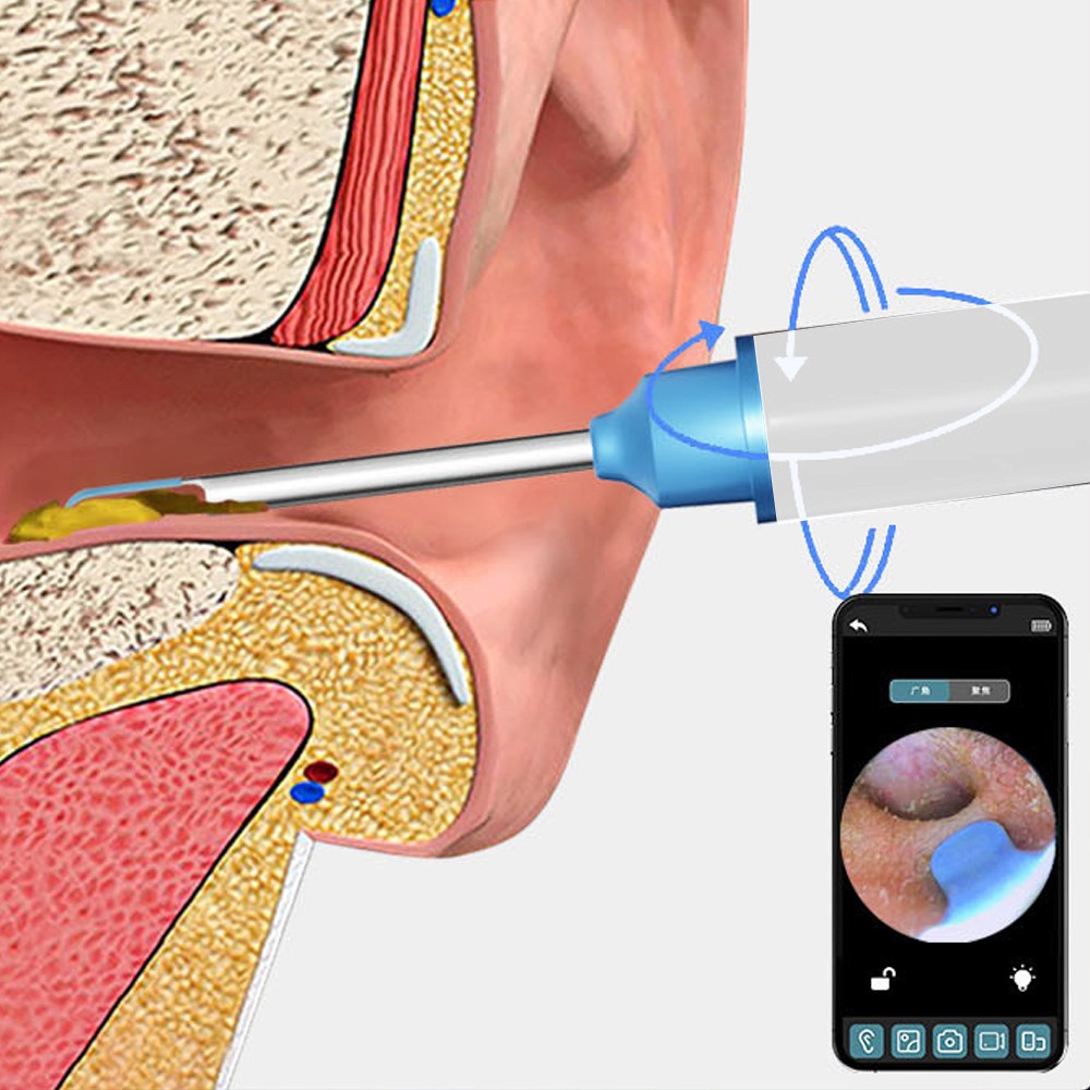Ear Wax Removal Tool Ear Cleaner with Camera Wireless WiFi Visual Ear Otoscope Earwax Removal Kit White