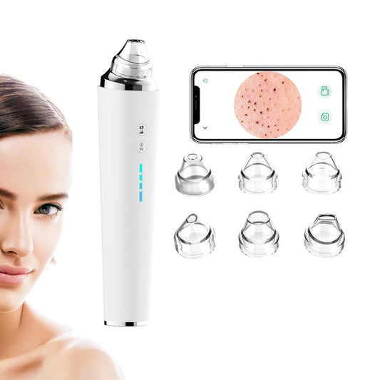 Blackhead Remover Pore Vacuum Visual Facial Pore Cleanser with 6 Suction Heads