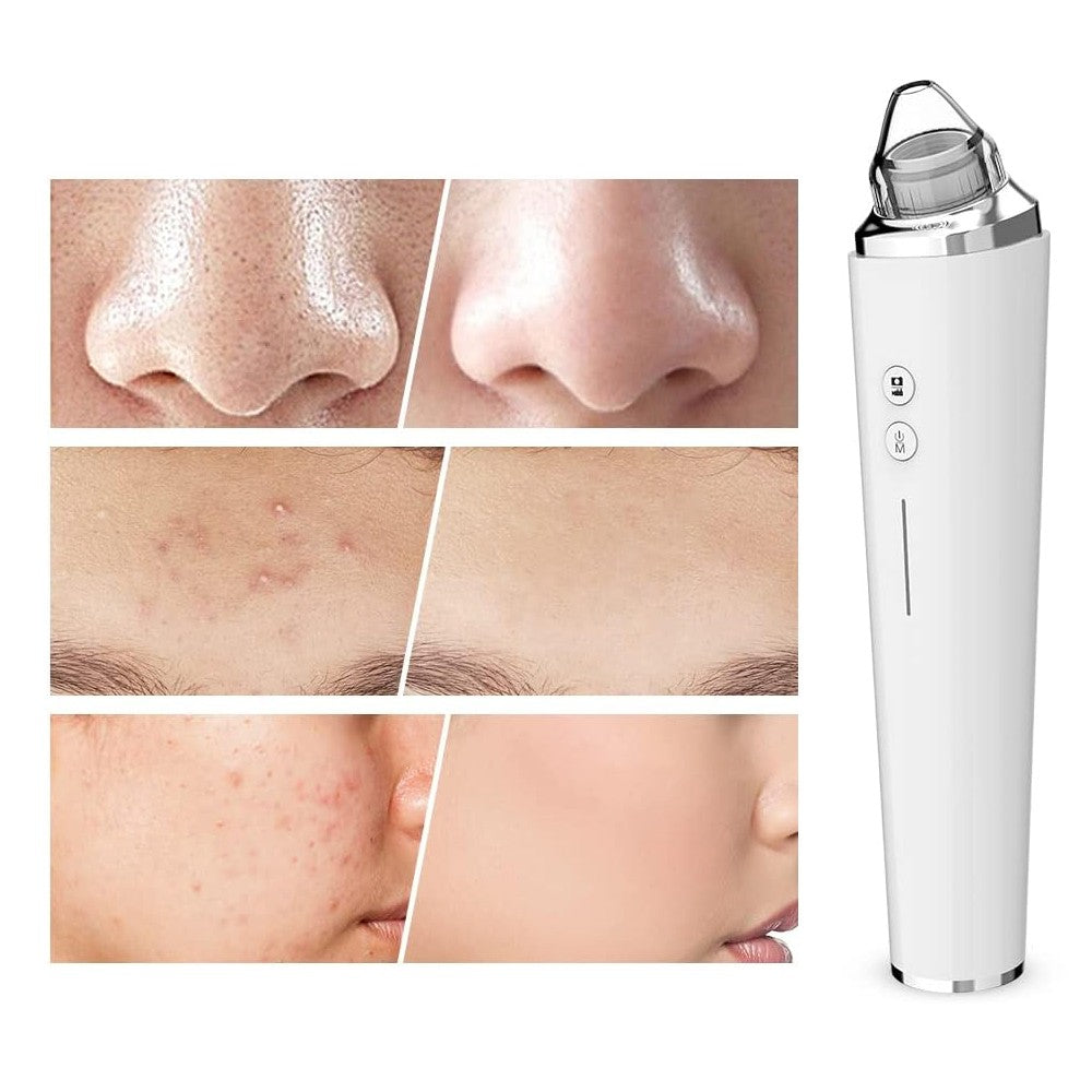 Blackhead Remover Pore Vacuum Visual Facial Pore Cleanser with 6 Suction Heads