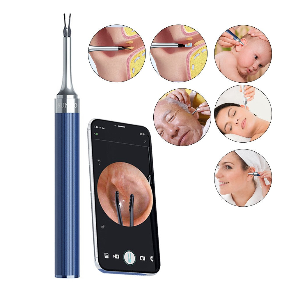 2-in-1 Visual Ear Wax Removal Tool Otoscope with Ear Scoops and Tweezer - Blue